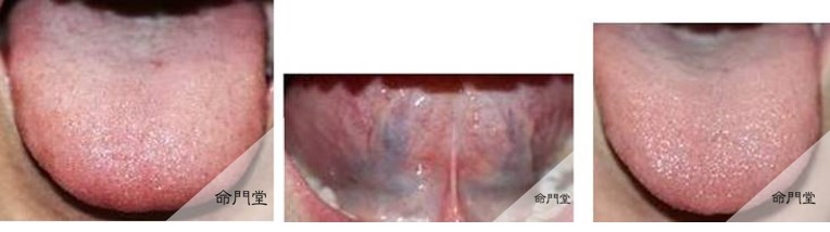 子宮内膜症による不妊症が9カ月後に妊娠 大阪で漢方相談するなら命門堂漢方薬局